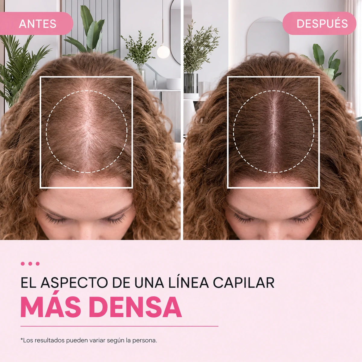 Sérum Anti-Caída con Cepillo Aplicador PDRN