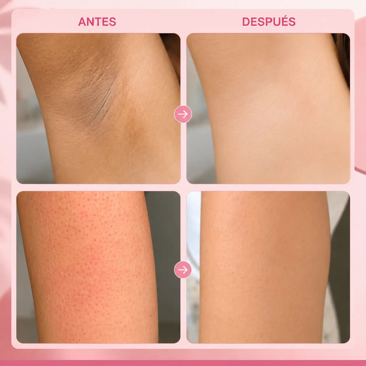 Spray exfoliante corporal - Ácido kójico + cúrcuma